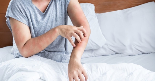 person itchy while in bed